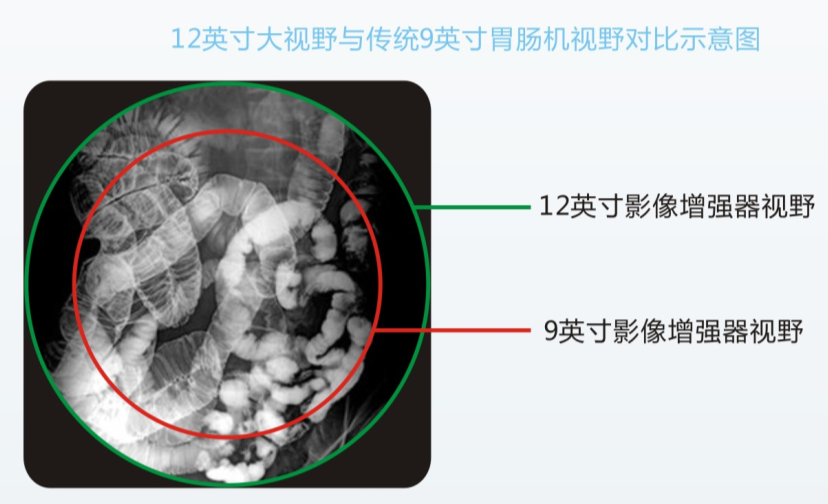 數(shu)字化平闆胃腸機(jī)PLD8600B