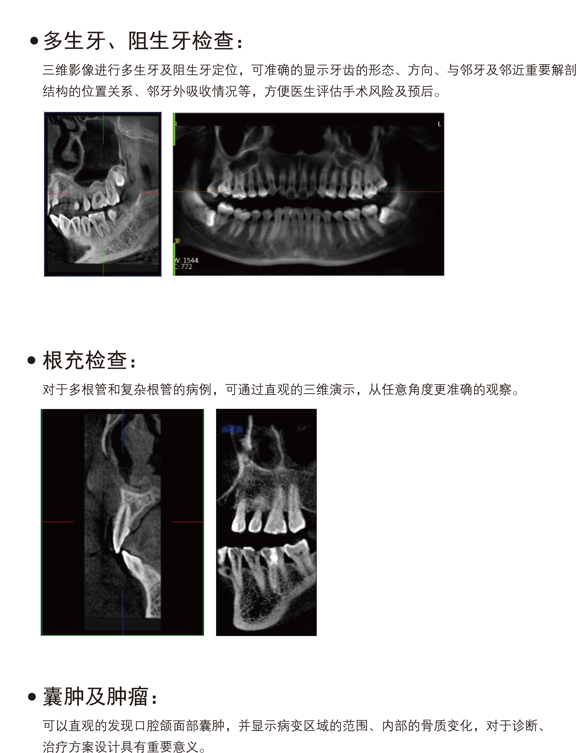 牙科(ke)CBCT-PLX3000A
